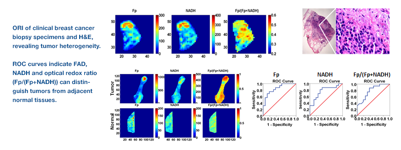 Britton Chance Laboratory of Redox Imaging - ORI of clinical breast specimen